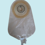 convex bags can manage leakage and reduce skin excoriations