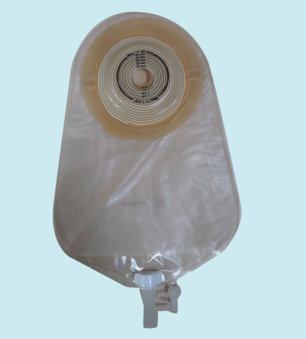 convex bags can manage leakage and reduce skin excoriations