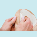 421631 Esteem+ Urostomy Pouch 45mm - Image 4